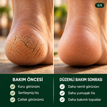 Topuk bakımı öncesi ve düzenli bakım sonrası görünüm
